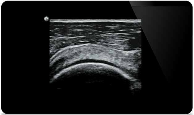 Responda r&aacute;pidamente con im&aacute;genes de todo el cuerpo