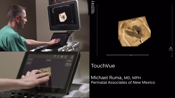 Demostraci&oacute;n de MPR Touch