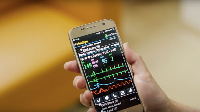Uso de dispositivos m&oacute;viles para gestionar alarmas de supervisi&oacute;n con v&iacute;deo Philips CareEvent